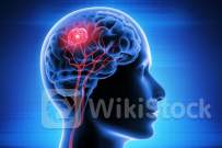 Fundamental Membaik, Ini Penyebab GoTo Gojek Tokopedia (GOTO) Betah Jadi Saham Gocap