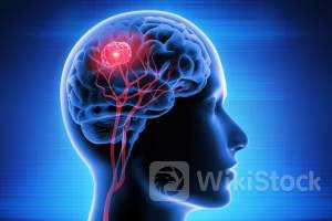 Fundamental Membaik, Ini Penyebab GoTo Gojek Tokopedia (GOTO) Betah Jadi Saham Gocap