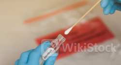 Vaxart Stock Is Moving Higher After The Bell: What's Going On？ - Vaxart (NASDAQ:VXRT)