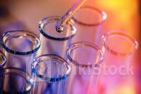 What Happened With Autonomix Medical Stock Today？ - Autonomix Medical (NASDAQ:AMIX)