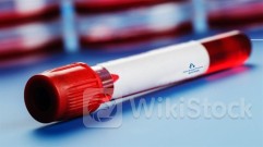 ＜Research＞UBS Raises HANSOH PHARMA (03692.HK) TP to $20.8, Rating Buy as Sector Top Pick