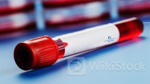 ＜Research＞UBS Raises HANSOH PHARMA (03692.HK) TP to $20.8, Rating Buy as Sector Top Pick