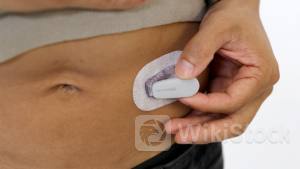 DexCom Stock Drops After Mixed Q2 Results, Weak Forward Guidance - DexCom (NASDAQ:DXCM)